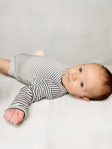 Baby in a striped outfit lying on a soft surface, looking curiously at the camera.